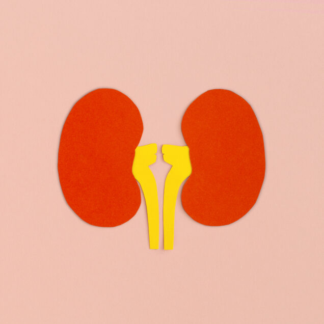 Kidney Transplant