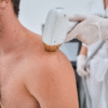 How Laser Hair Removal Is Becoming a Self-Care Staple